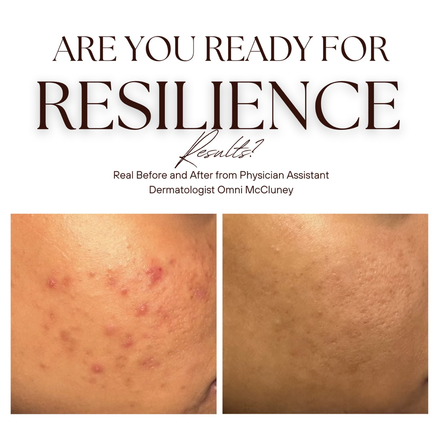 The Renew Retinol Cream