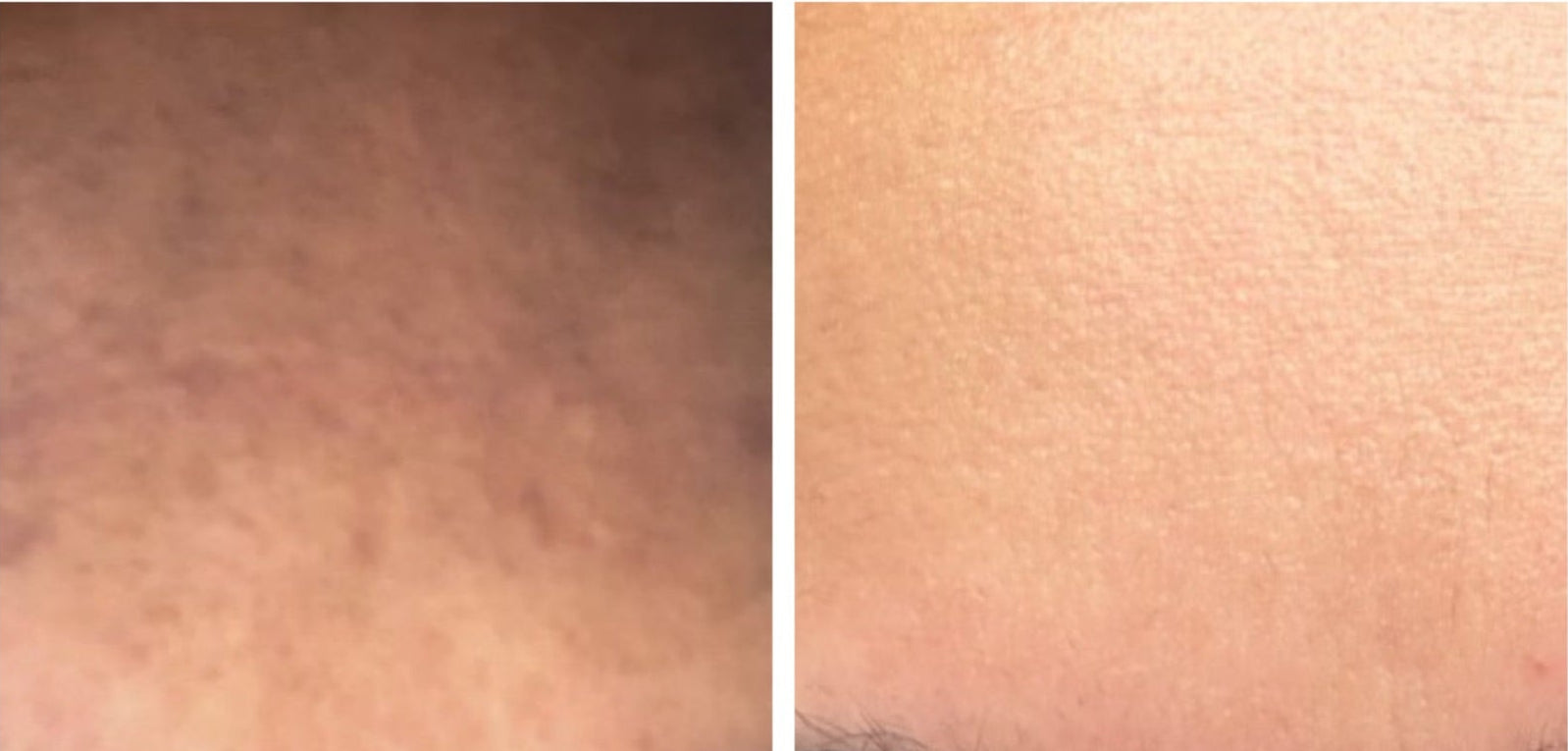 Advertisement for a retinol cream with before and after skin comparison on a white background.