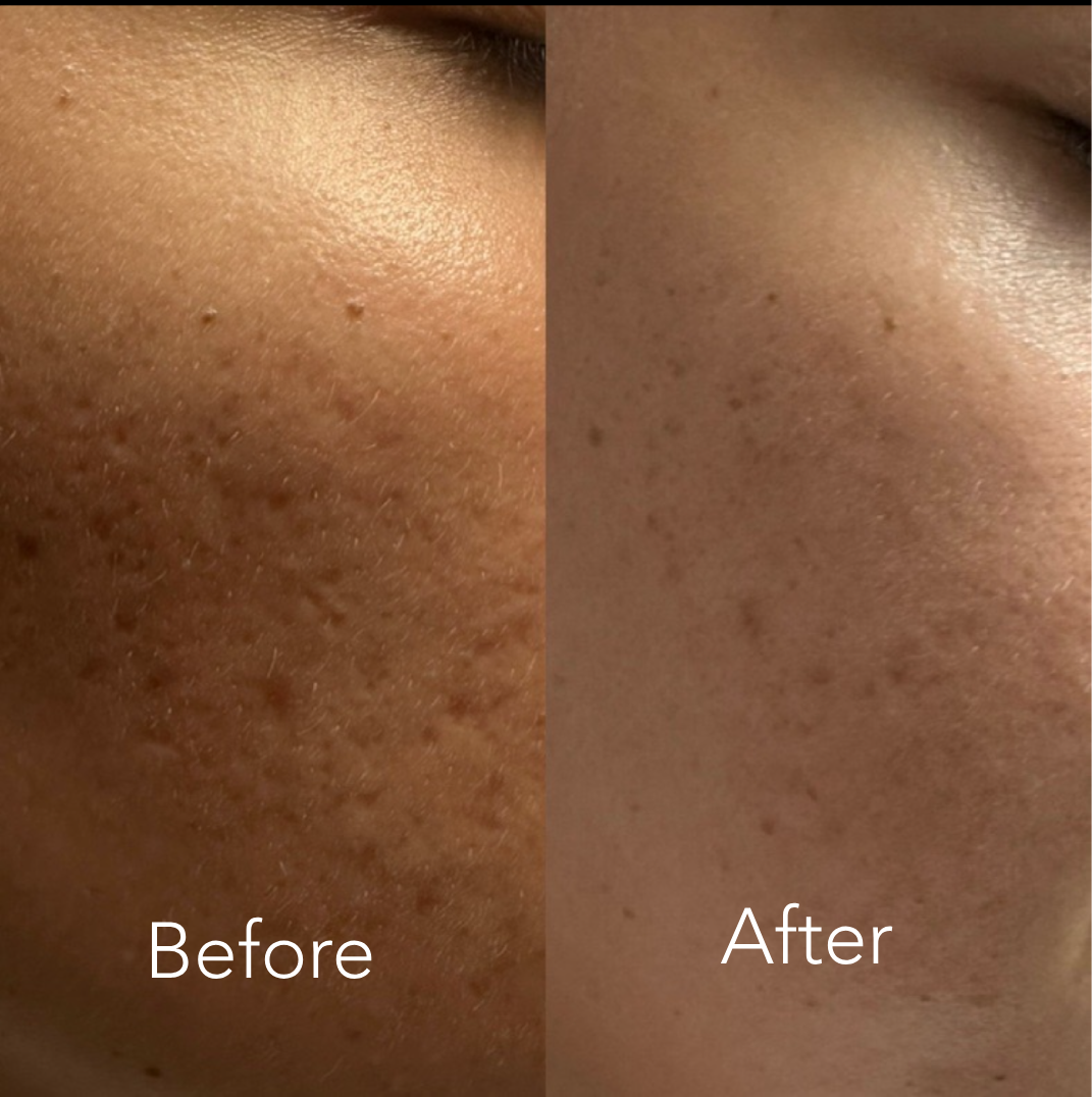 The Renew Retinol Cream