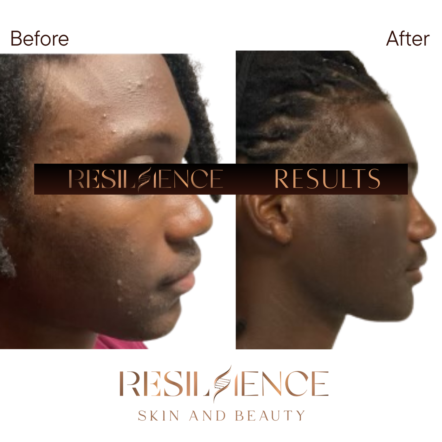 The Renew Retinol Cream