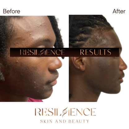 The Renew Retinol Cream