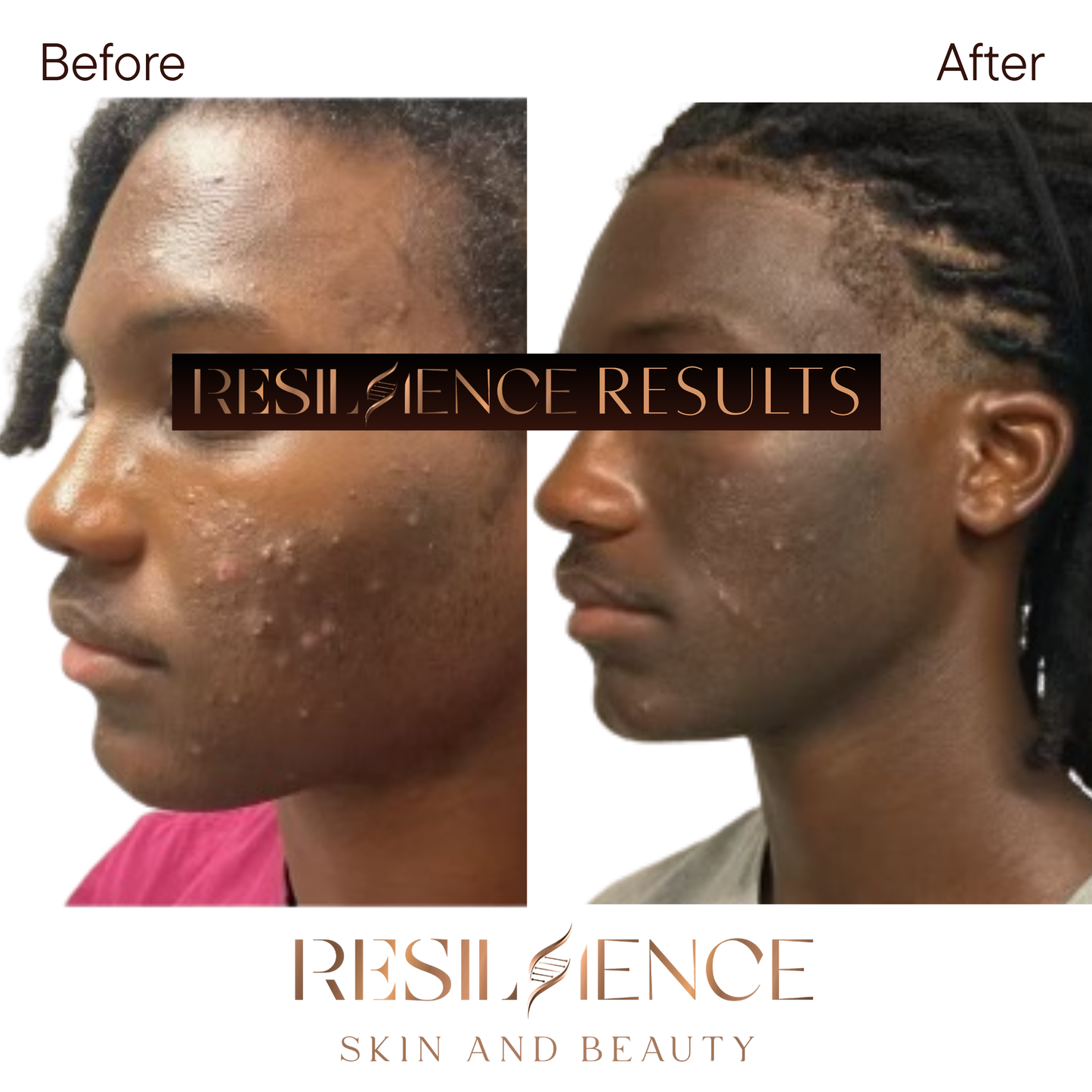 The Renew Retinol Cream