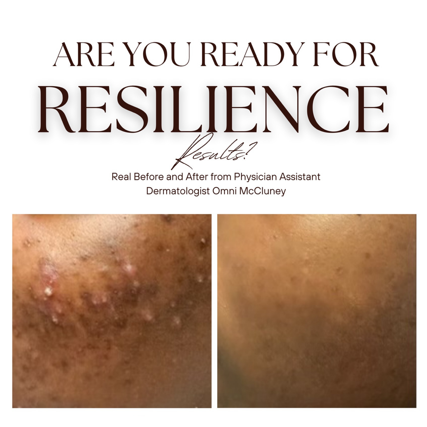 The Renew Retinol Cream