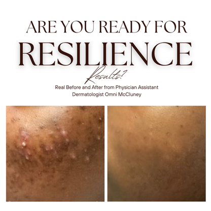 The Renew Retinol Cream