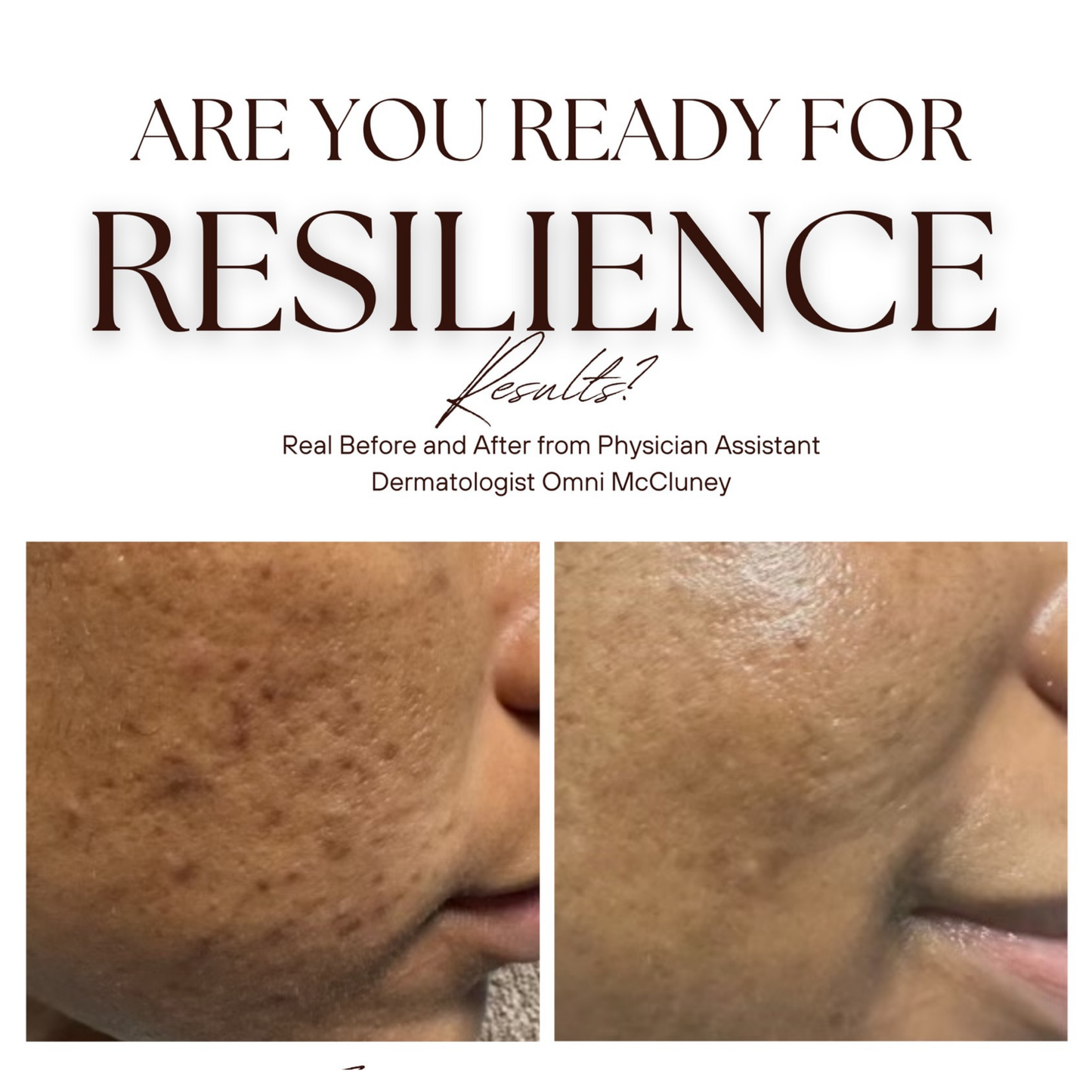 The Renew Retinol Cream