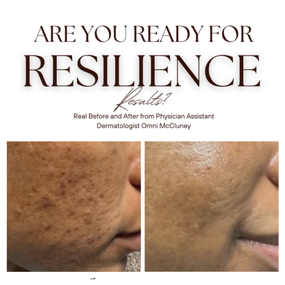 The Renew Retinol Cream