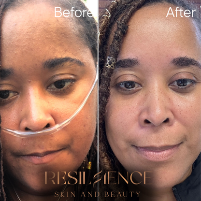 The Renew Retinol Cream