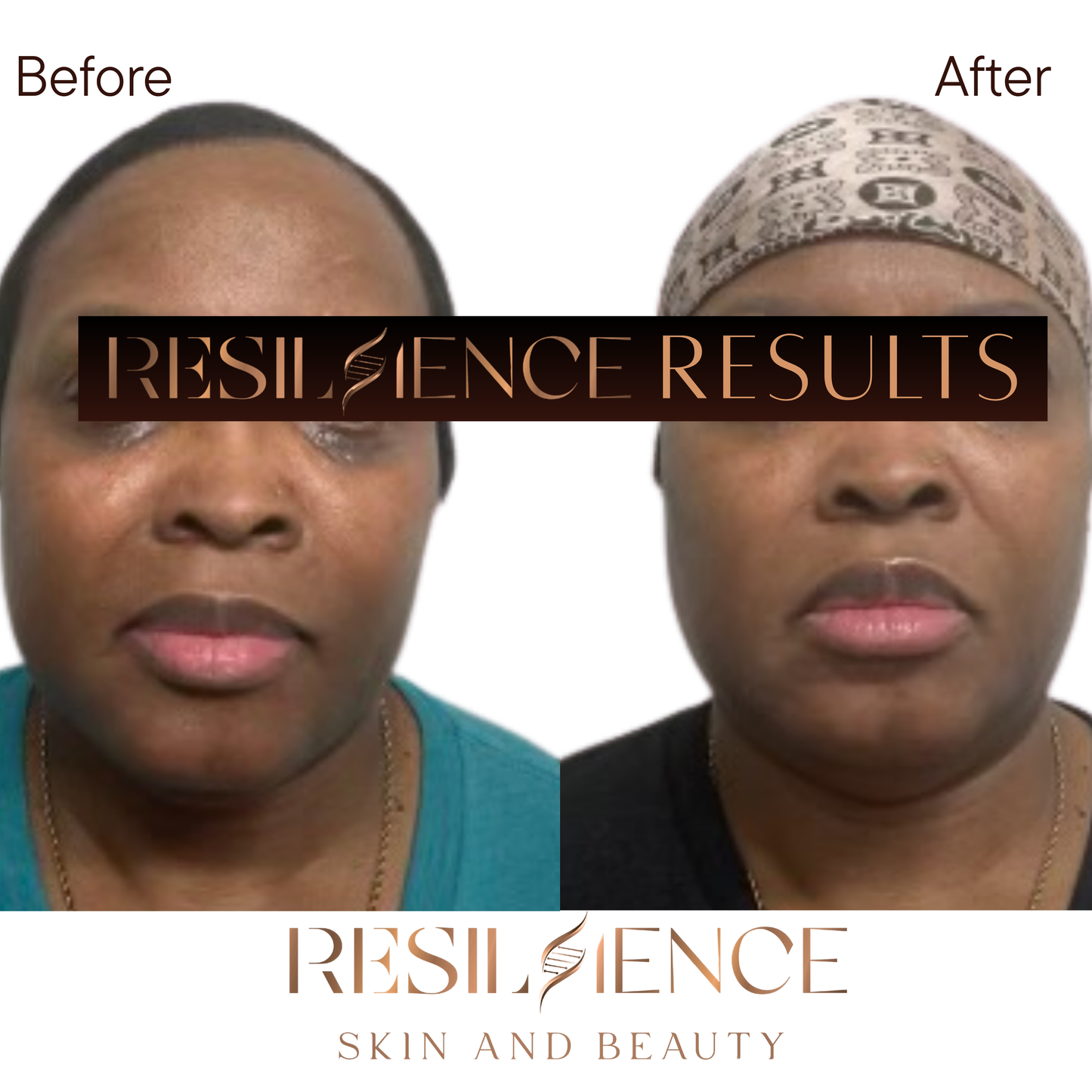 The Renew Retinol Cream