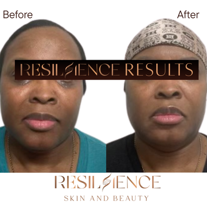 The Renew Retinol Cream